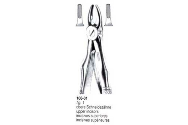 CLESTE EXTRACTIE 106-01