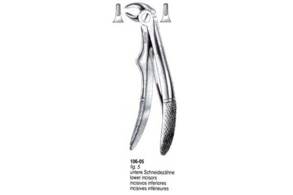 CLESTE EXTRACTIE 106-05