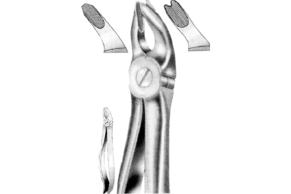 CLESTE EXTRACTIE 112-18